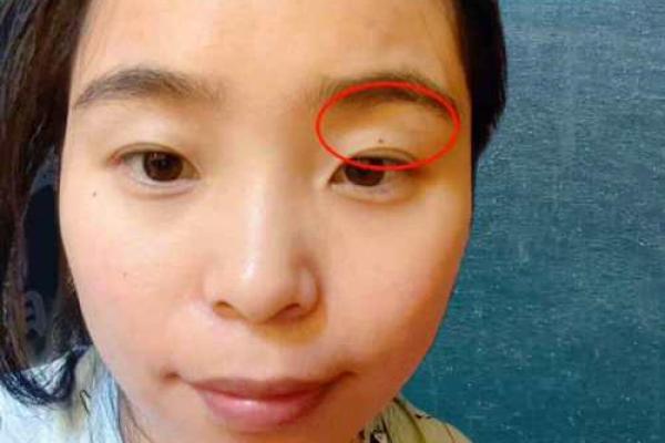 女人额头太高风水好不好女孩子的