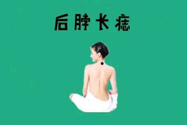 风水上女生脖子后面有痣代表什么啊