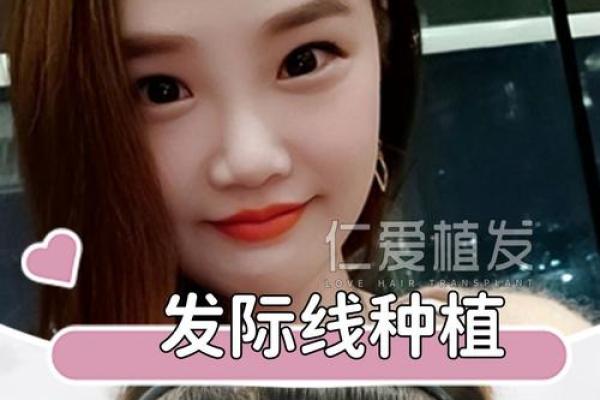 风水上发际线高有福气发际线图片