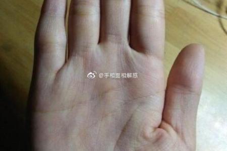 后脑勺有三条竖杠 后脑勺头皮三条竖纹算命