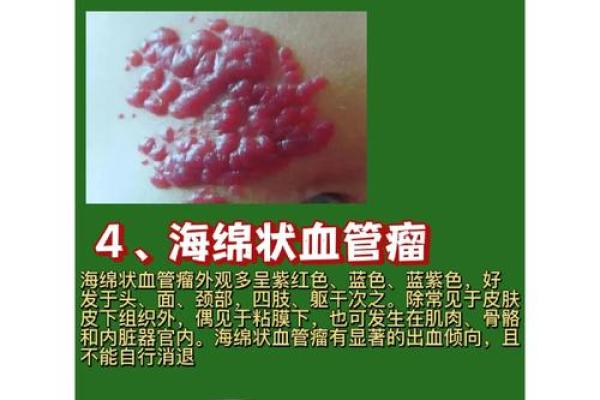 风水学上胎记中的有说明什么