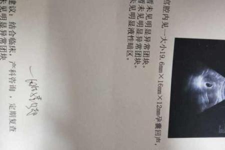 算命说打过胎实际没有胎心