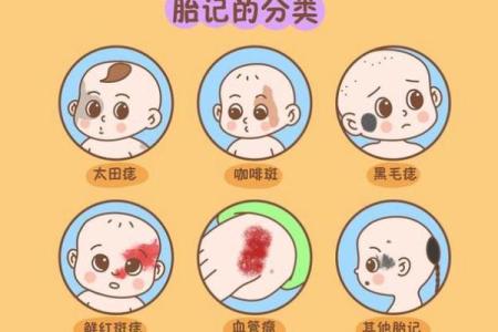 看胎记位置算命