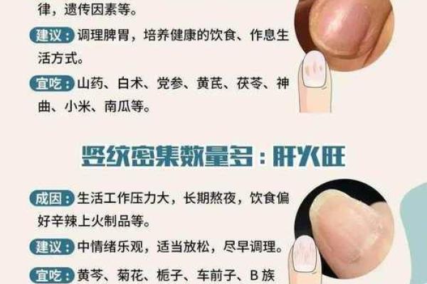 指甲 风水