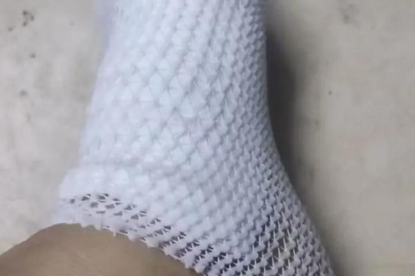 生活中突然摔跤有什么风水讲究吗-