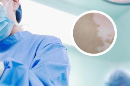 屁股有白斑风水