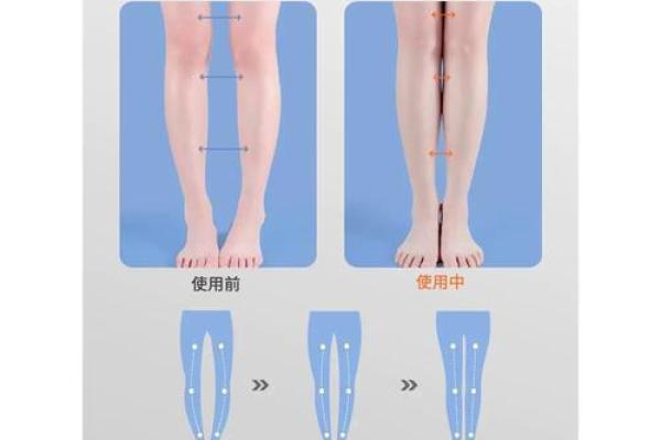 怎样纠正内八字,14岁内八字怎么矫正最快
