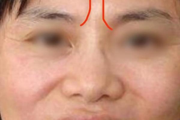男人印堂八字纹的事业运好吗