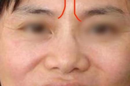 男人印堂八字纹的事业运好吗