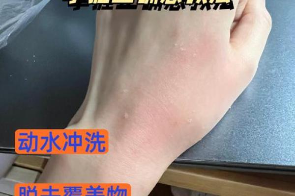 八字烫伤案例:交战必应灾 八字烫伤案例:交战必应灾