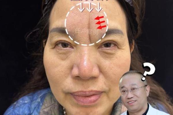 川字纹几种类型,一定要了解清楚:悬针纹、八字纹、双雀纹 川字纹几种类型,一定要了解清楚:悬针纹、八字纹、双雀纹