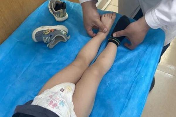 小腿内八字 小腿内八字