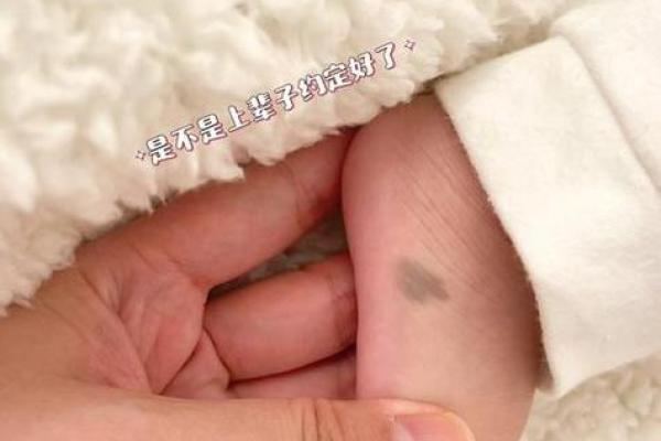 腿上不同位置的胎记算命