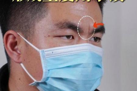 男人印堂八字纹的命运