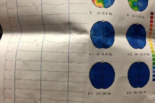 psychopath人格测试