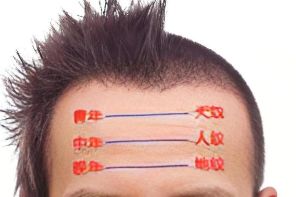 额头胎记算命