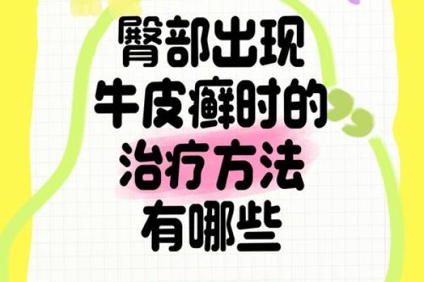 屁股有白斑风水