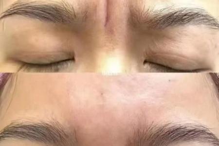 川字纹几种类型,一定要了解清楚:悬针纹、八字纹、双雀纹