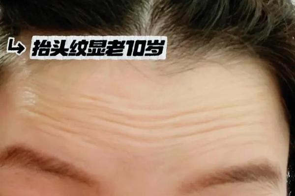 额头八字纹 额头八字纹