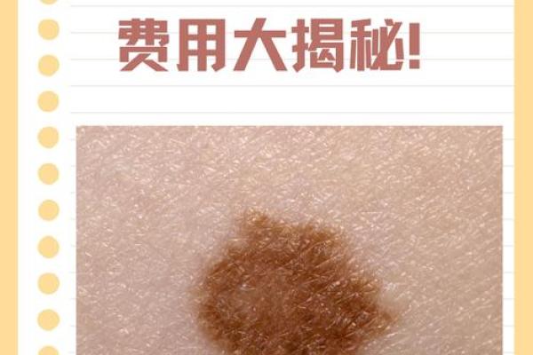 胎记算命：从胎记看运势