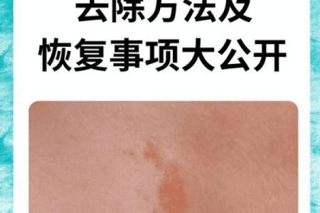 胎记算命：从胎记看运势