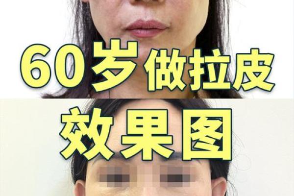 怎么消除八字纹