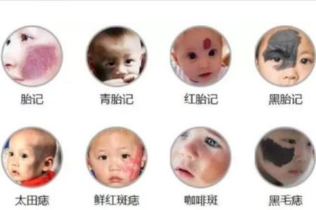 身体上的胎记位置不同算命分析