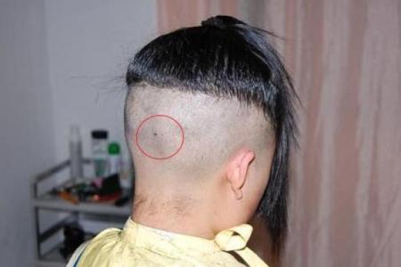 风水上后脑勺长痣代表什么意思