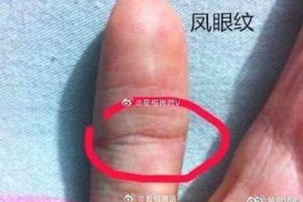 手相算命:假夫子眼的命运如何 手相算命:假夫子眼的命运如何