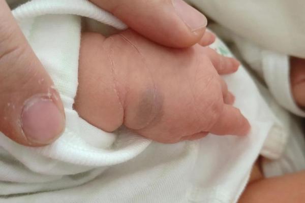 男婴眉心长“月牙”胎记,母亲带他算命后神秘失踪,至今下落不明 男婴眉心长“月牙”胎记,母亲带他算命后神秘失踪,至今下落不明