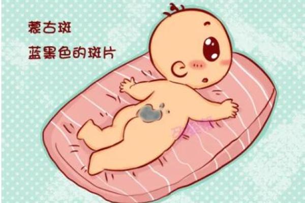 胎记算命讲解 胎记算命讲解